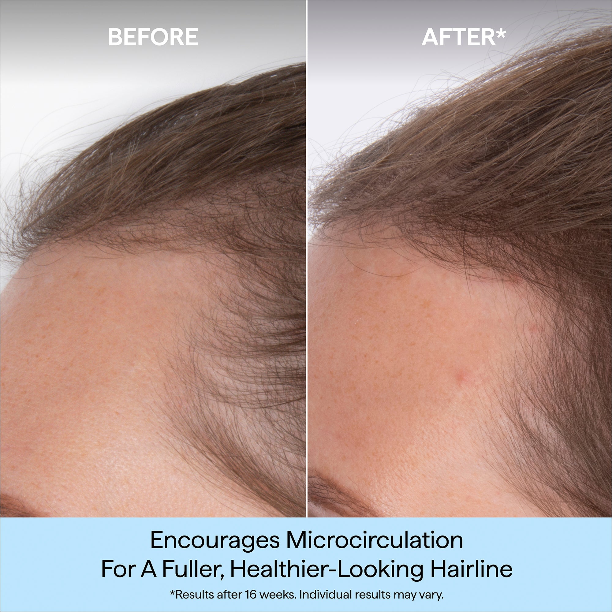 Destined For Density™ MegaStrength+ Caffeine + Biotin Peptide Density Serum
