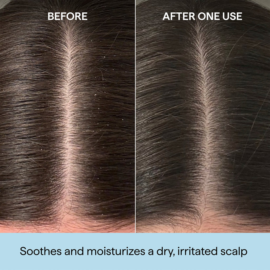 Scalp Revival Rosemary Pre-Wash Oil, 1oz
