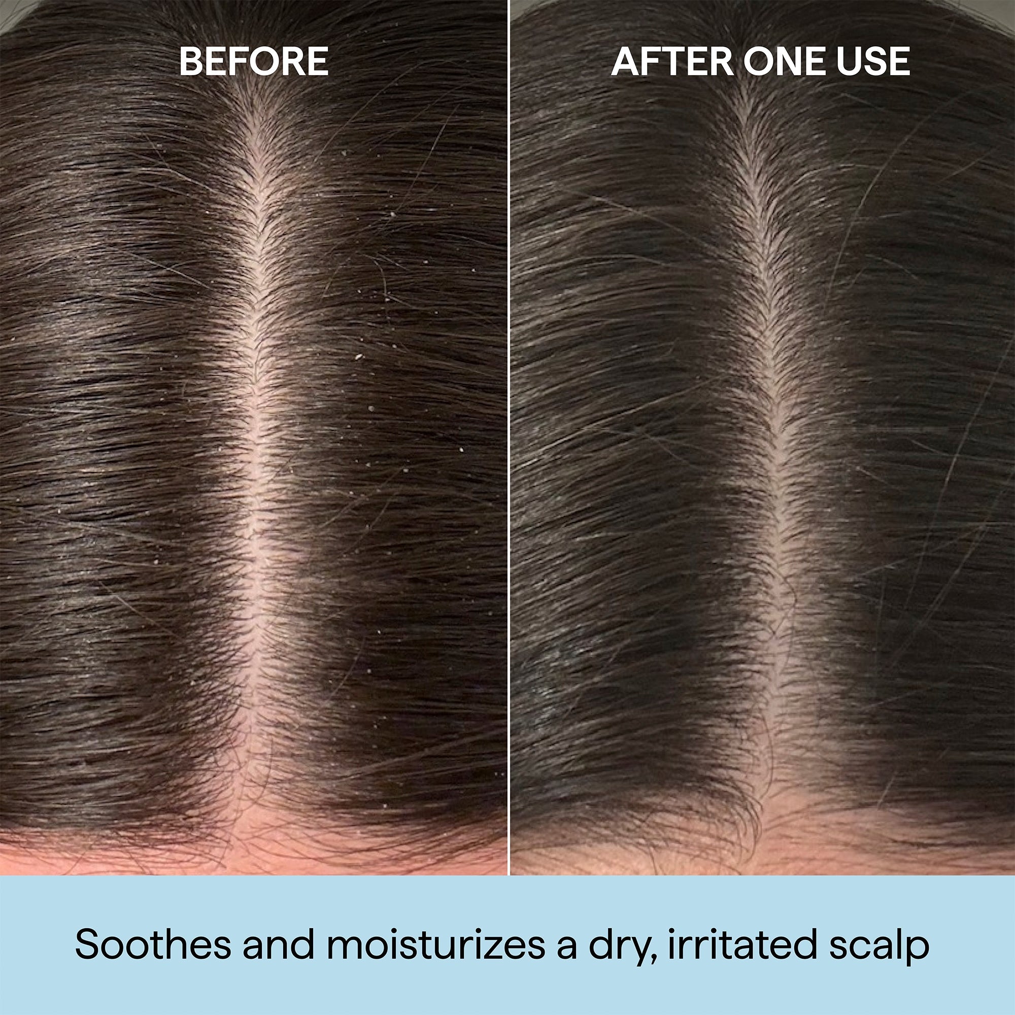 Scalp Revival Rosemary Pre-Wash Oil, 1oz