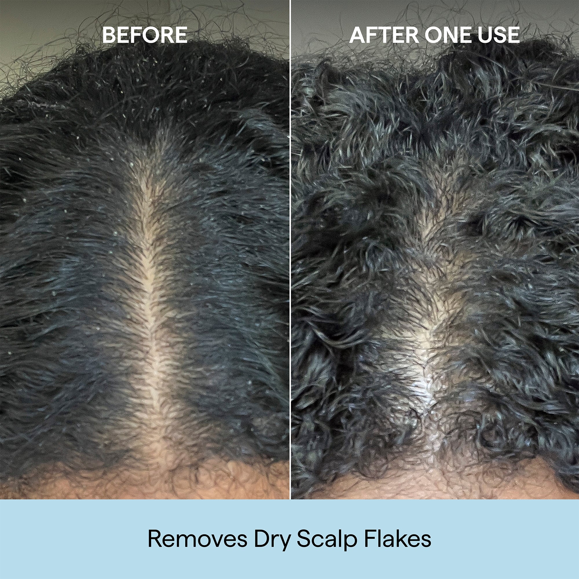 Scalp Revival™ Charcoal + Coconut Oil Micro-Exfoliating Shampoo | Scalp Scrub