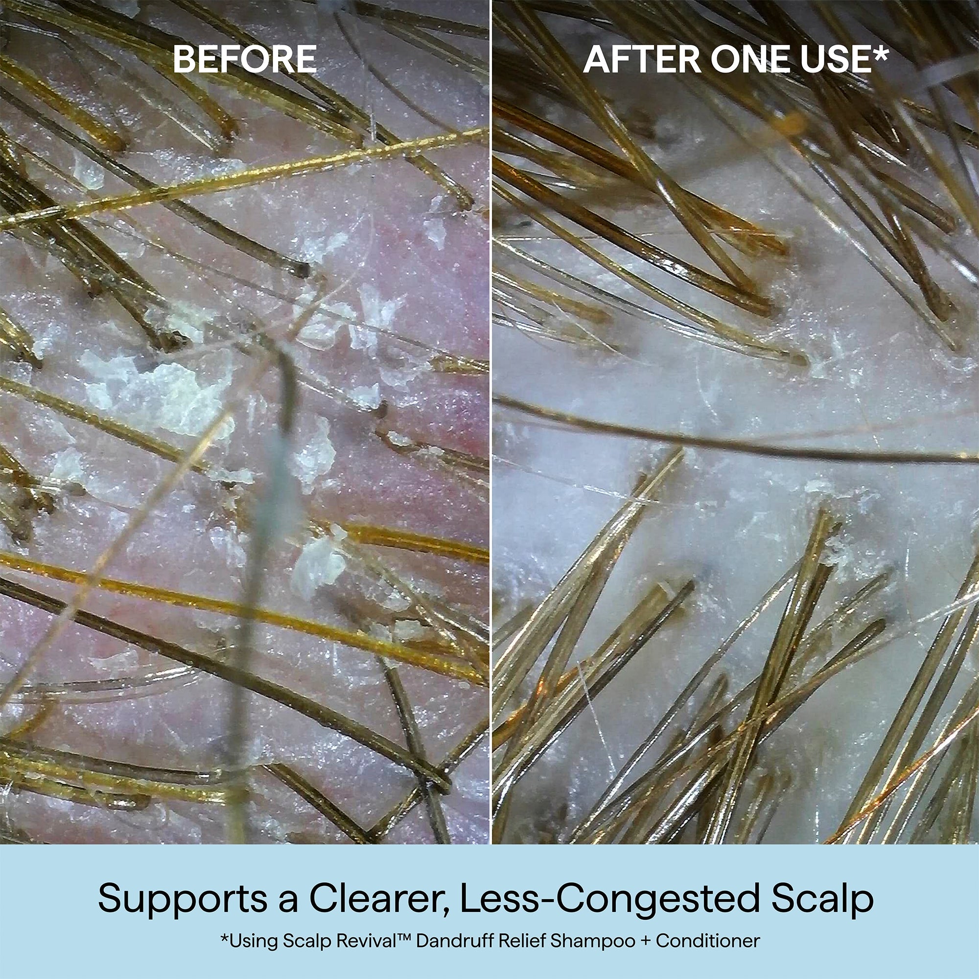 Scalp Revival™ Dandruff Relief Conditioner with Charcoal + 1.8% Salicylic Acid