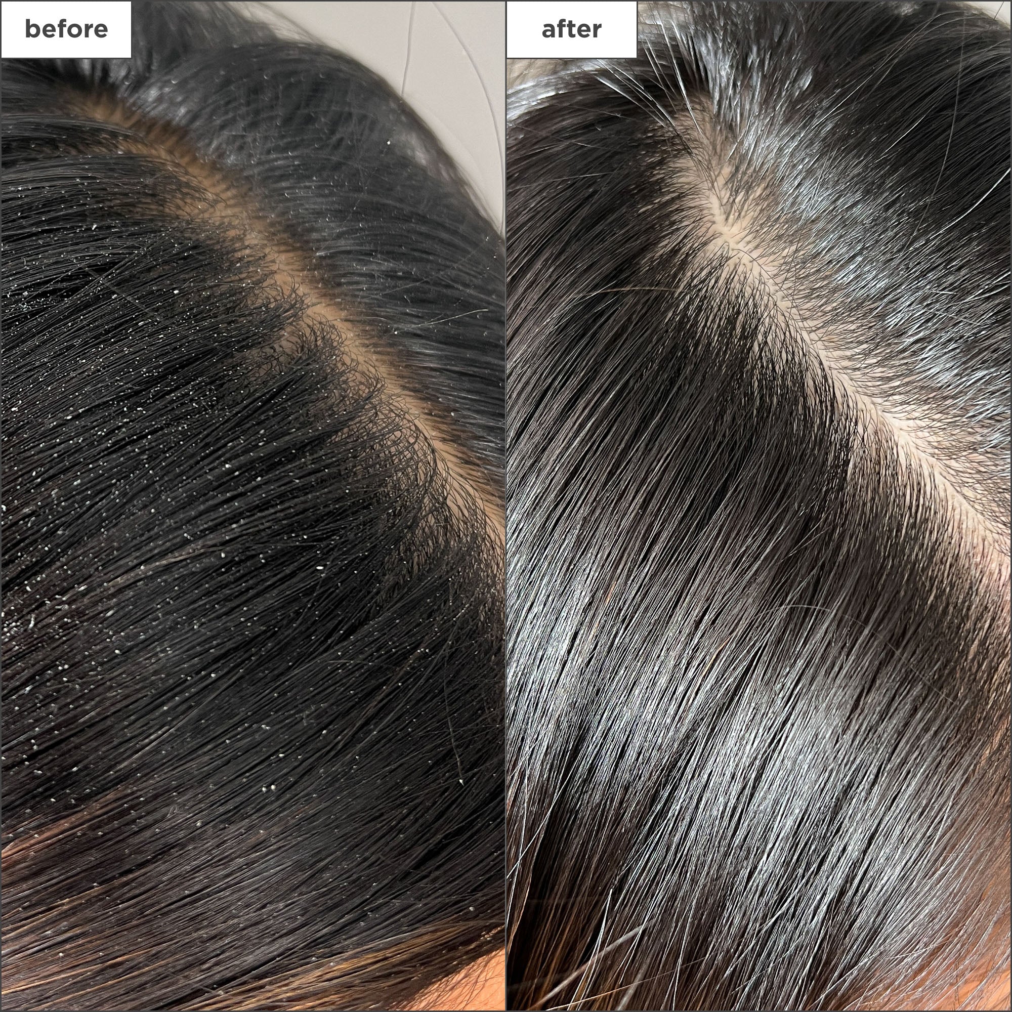 Scalp Revival Charcoal + Tea Tree Buildup Detox Spray