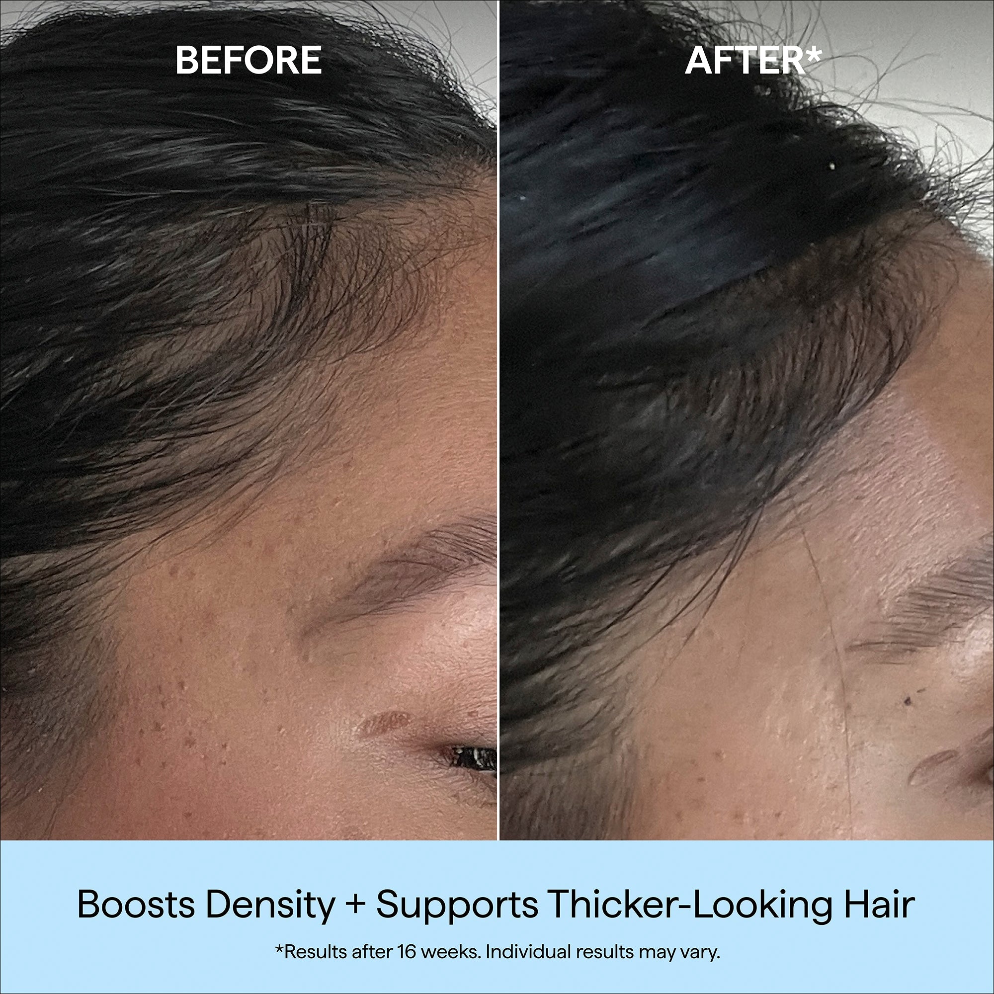 Destined For Density™ MegaStrength+ Caffeine + Biotin Peptide Density Serum