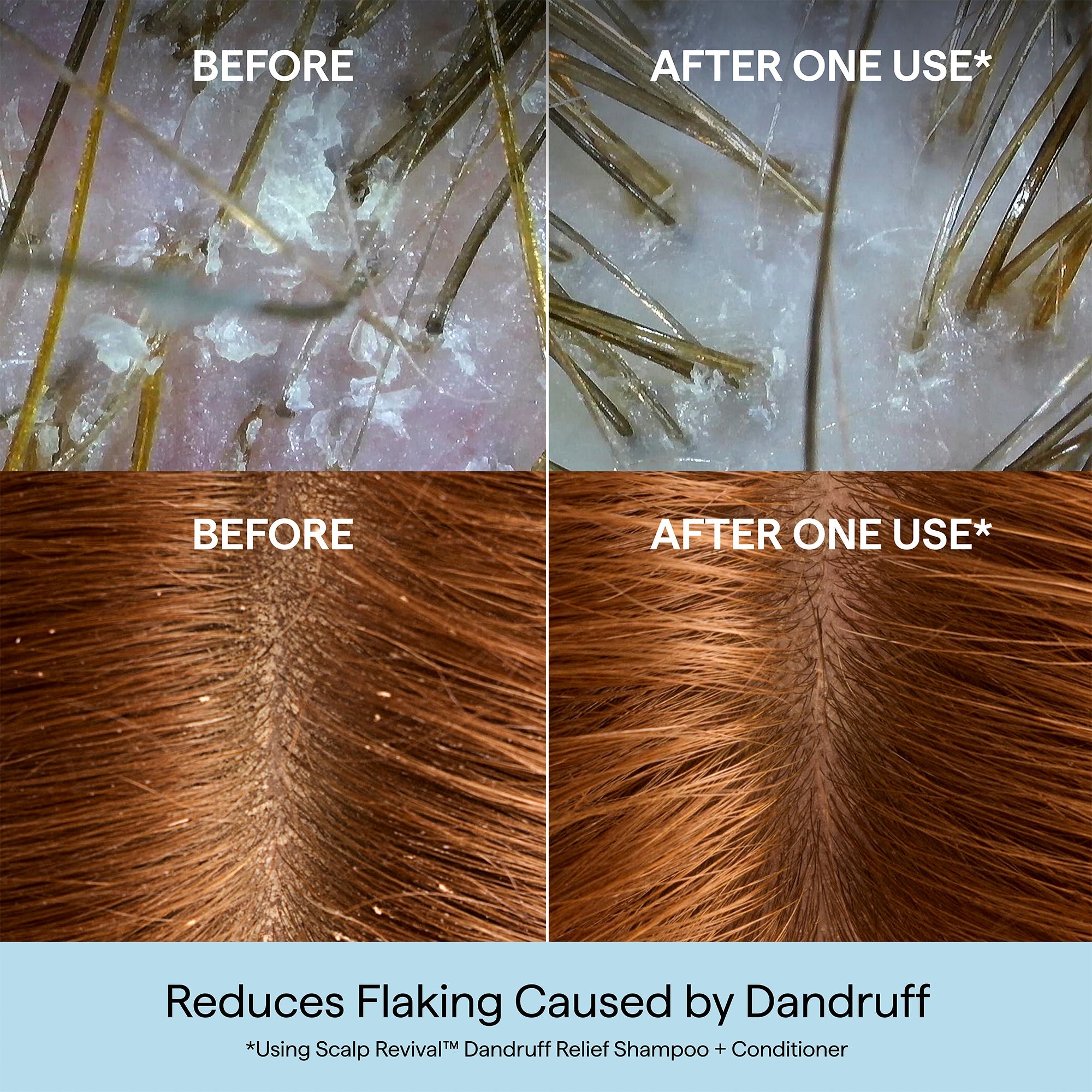 Scalp Revival™ Dandruff Relief Shampoo with Charcoal + 3% Salicylic Acid