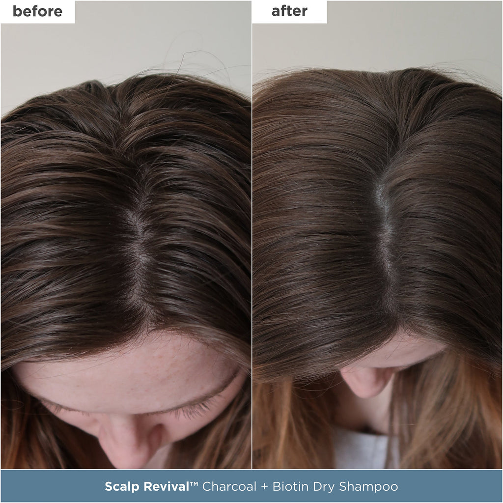 Scalp Soothing Starter Set™