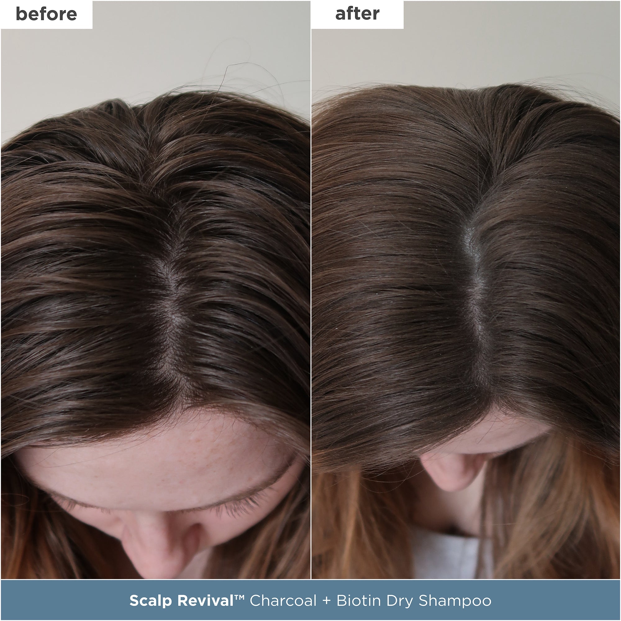 Scalp Soothing Starter Set™