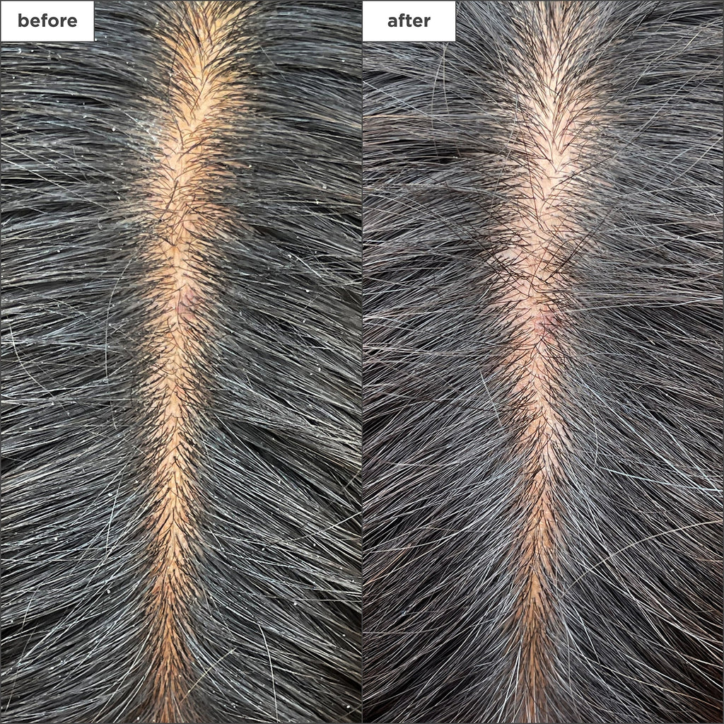 Scalp Revival Charcoal + Tea Tree Cooling Hydration Scalp Mask