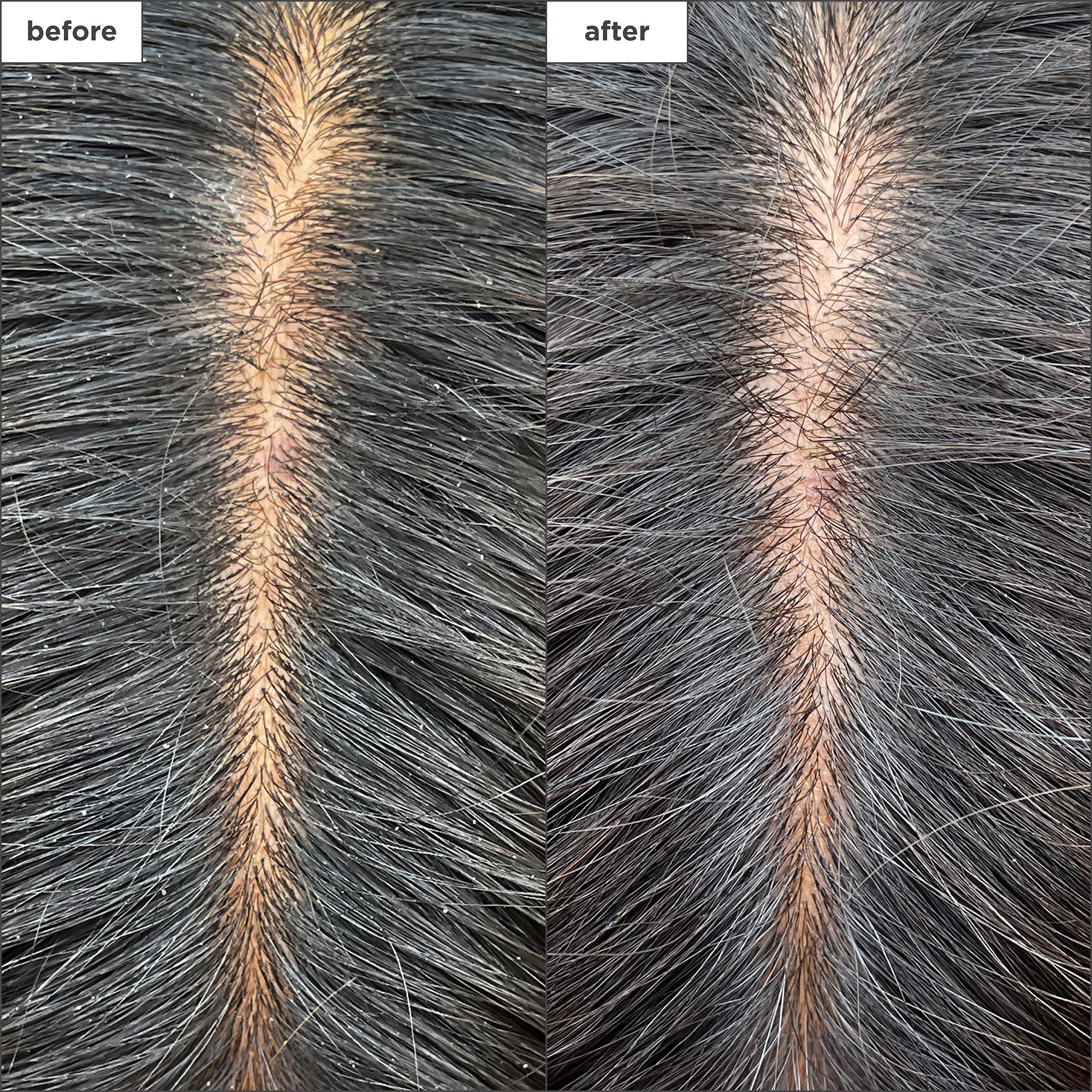 Scalp Revival Charcoal + Tea Tree Cooling Hydration Scalp Mask